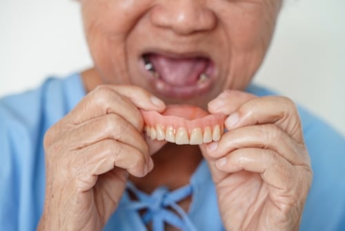 Loose Dentures in Walker County | Mini Implants in Jasper, AL