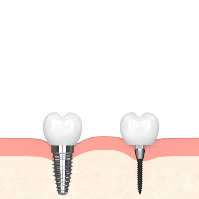 Dentist in Jasper, AL | Bivona Family Dental | Care for Your Smile!