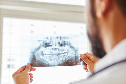 Oral Surgery in Jasper, AL | Find Gentle and Affordable Solutions