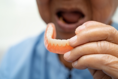 How To Fix Loose Dentures in Jasper, AL | Free Implant Consults