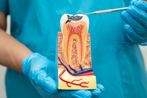 Root Canal Pain Relief [Video Q&A] | Emergency Dental Care in AL